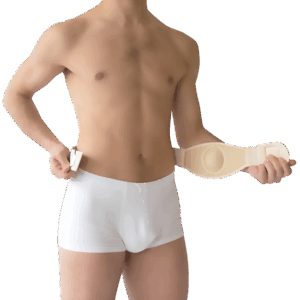 ΟΜΦΑΛΕΠΙΔΕΣΜΟΣ